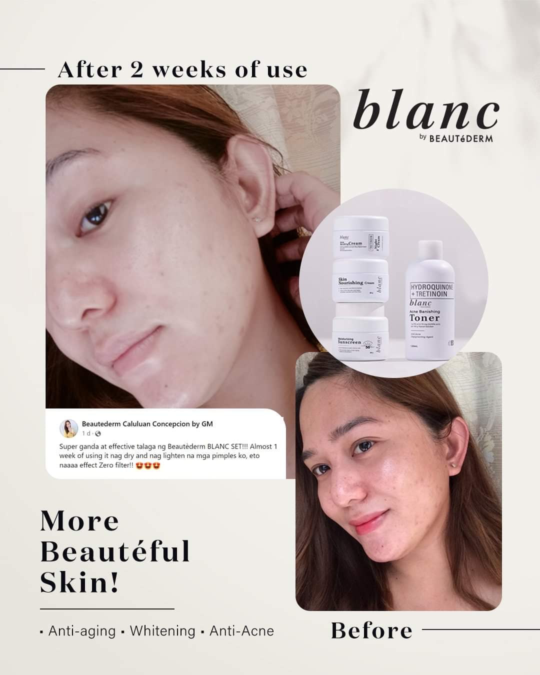 Blanc Set Regular Size (2 months use) with FREEBIES