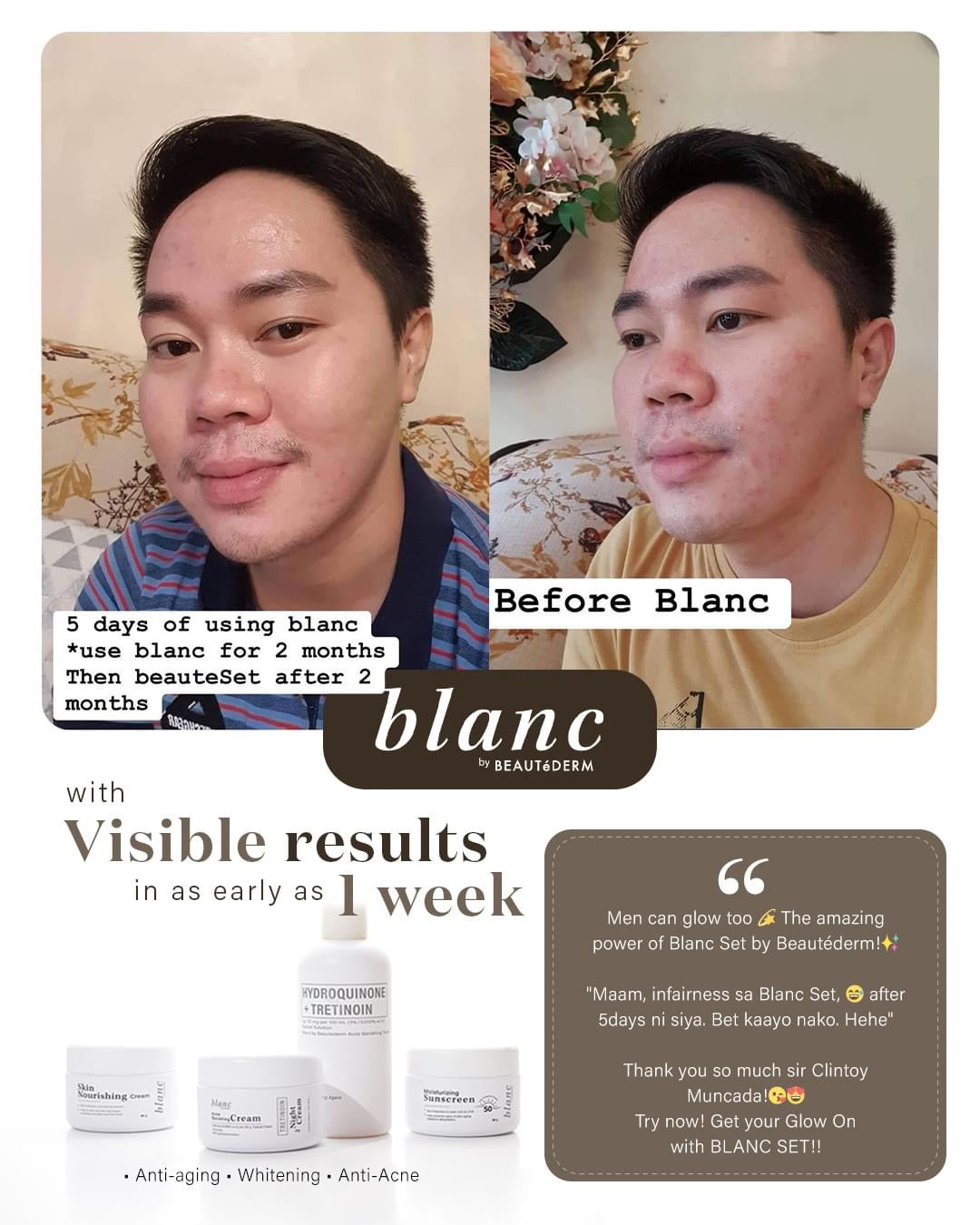 Blanc Set Regular Size (2 months use) with FREEBIES