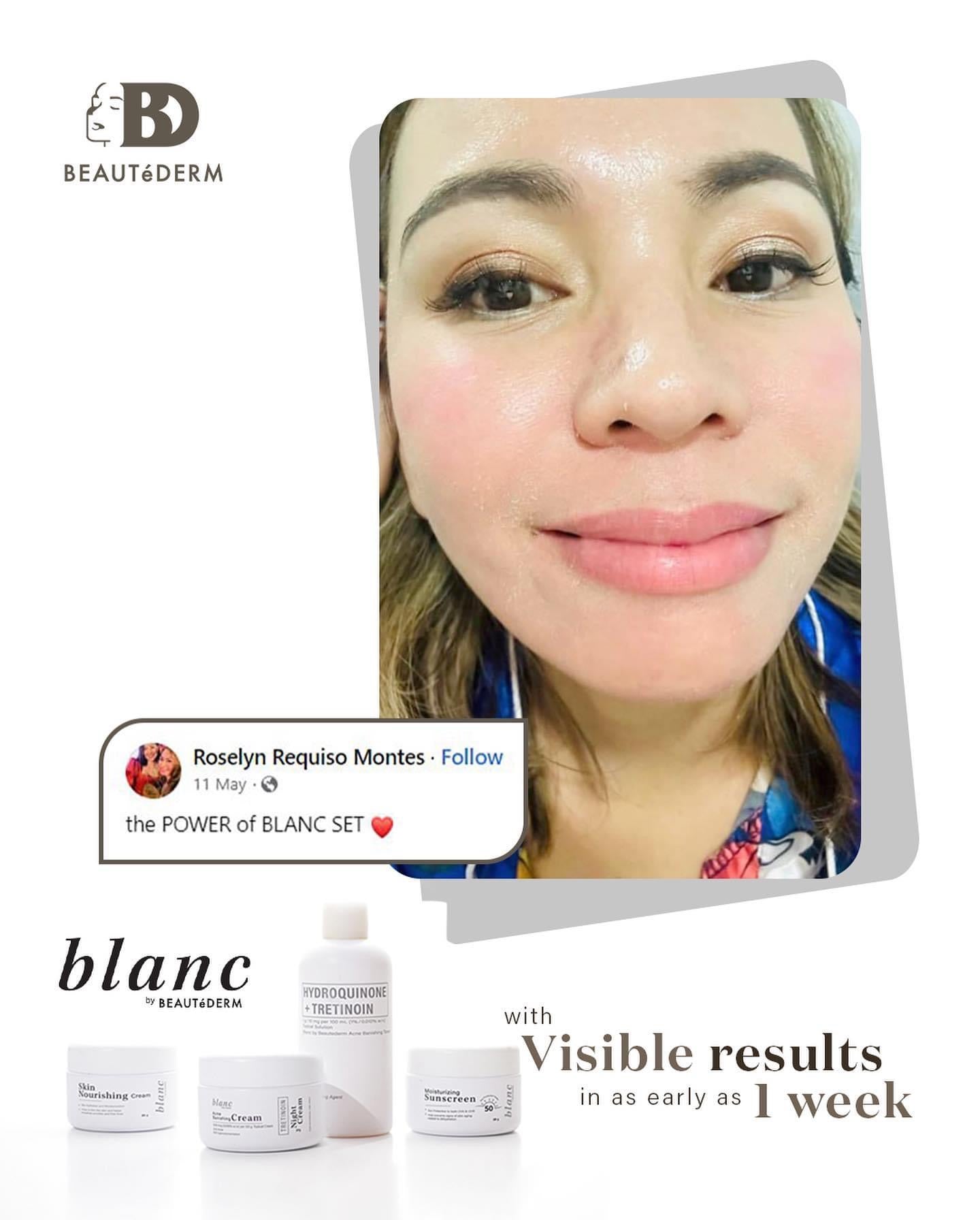 Blanc Trial Set (60ml toner and 10gram creams, 1 month use) with FREEBIES