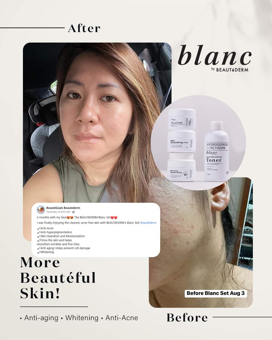 Blanc Trial Set (60ml toner and 10gram creams, 1 month use) with FREEBIES