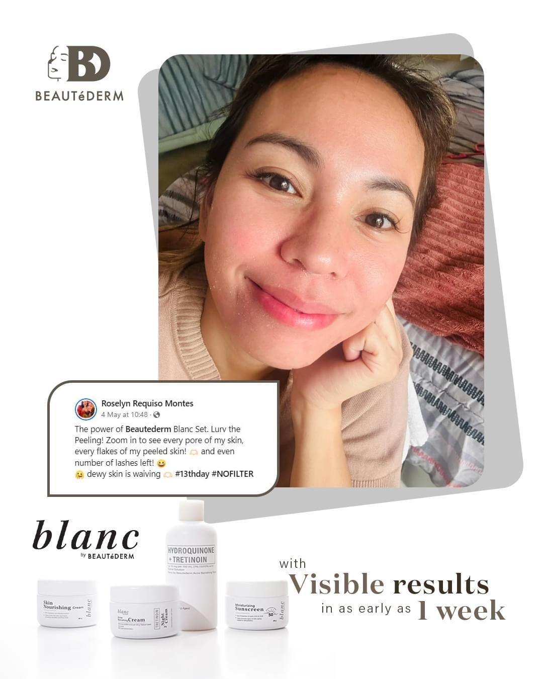 Blanc Set Regular Size (2 months use) with FREEBIES