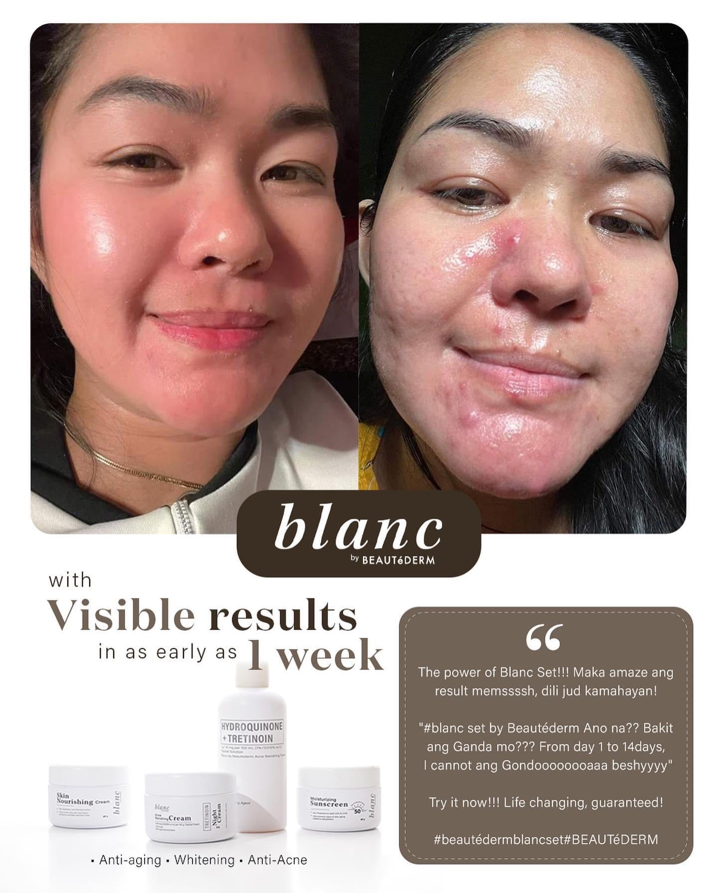 Blanc Trial Set (60ml toner and 10gram creams, 1 month use) with FREEBIES