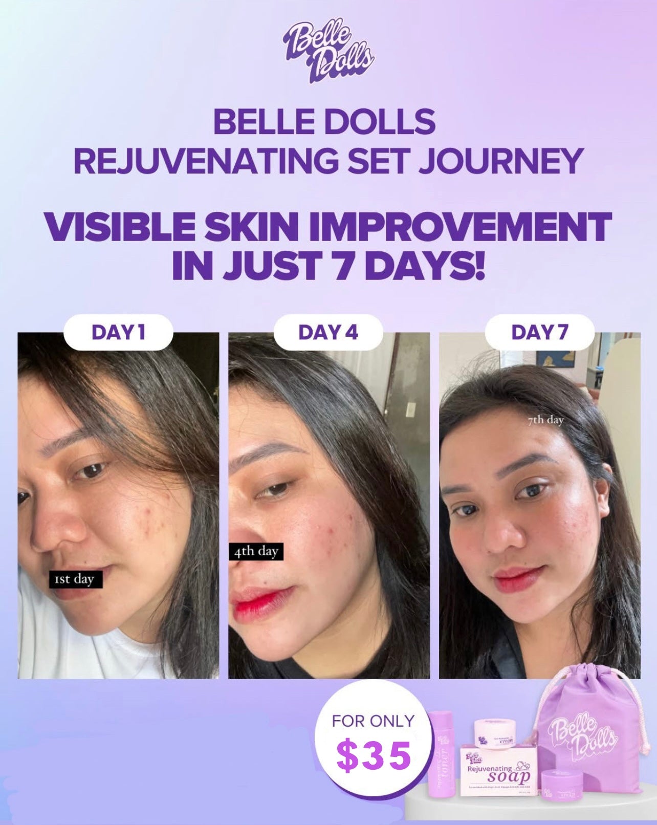 Belle Dolls Rejuvenating Set (1 month use)